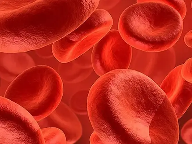 Anemia ferropriva: Causas, sintomas, tratamento e prevenção