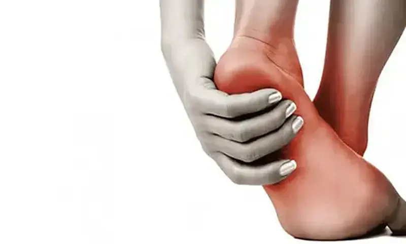 Fascite plantar