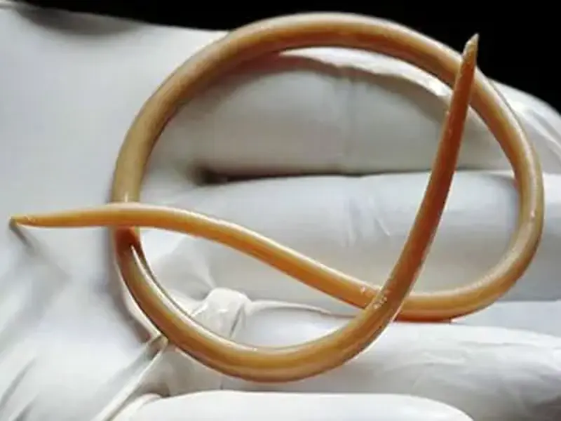Verme adulto de Ascaris lumbricoides sobre a mão enluvada de um profissional de saúde