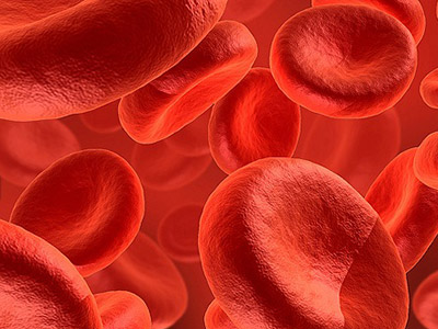 anemia ferropriva