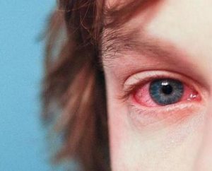 Zymar alergia ocular