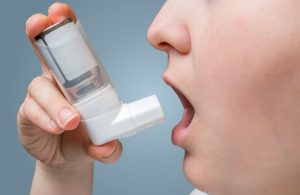 Montelair asma